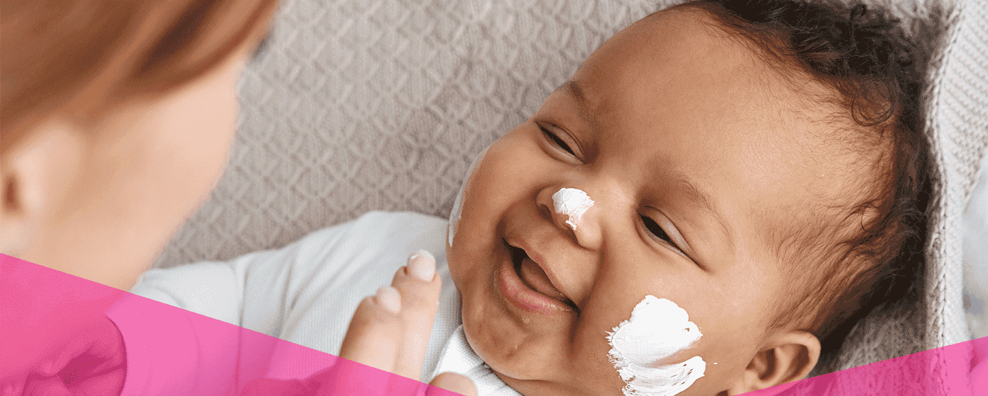 Irritación en la piel de bebés