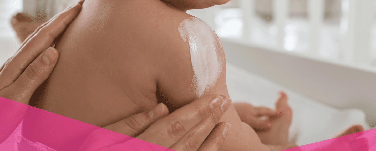 Irritación en la piel de bebés